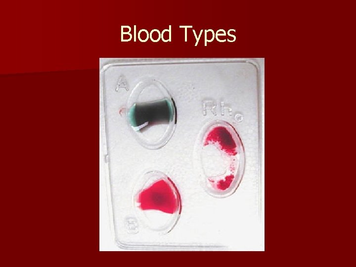Blood Types 