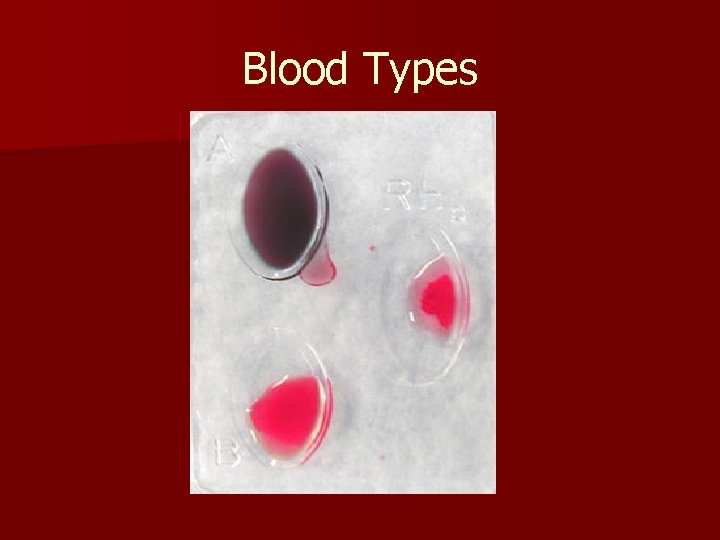 Blood Types 