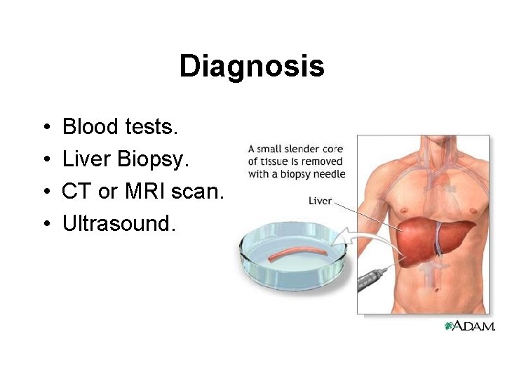 Diagnosis • • Blood tests. Liver Biopsy. CT or MRI scan. Ultrasound. 