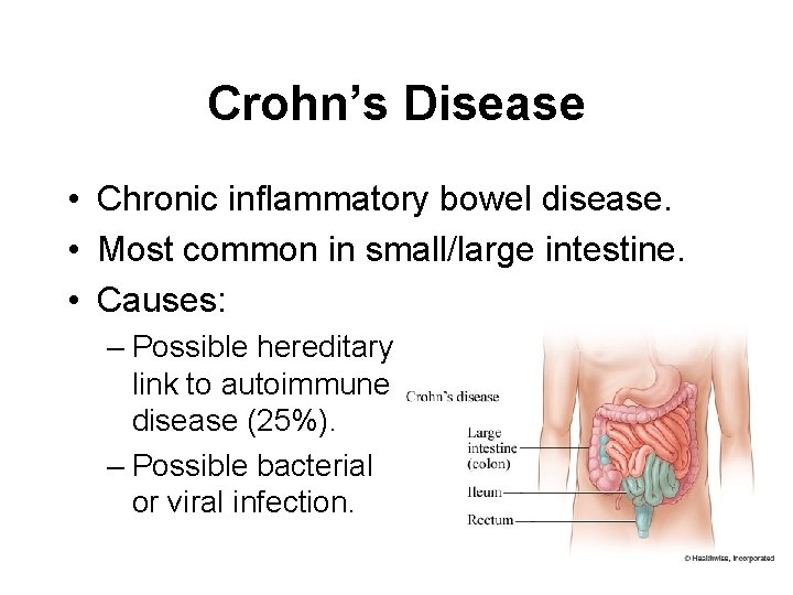 Crohn’s Disease • Chronic inflammatory bowel disease. • Most common in small/large intestine. •