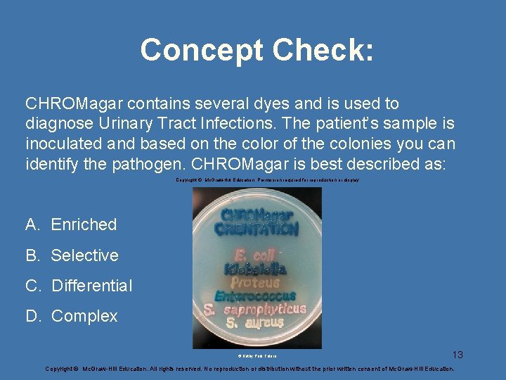 Concept Check: CHROMagar contains several dyes and is used to diagnose Urinary Tract Infections.