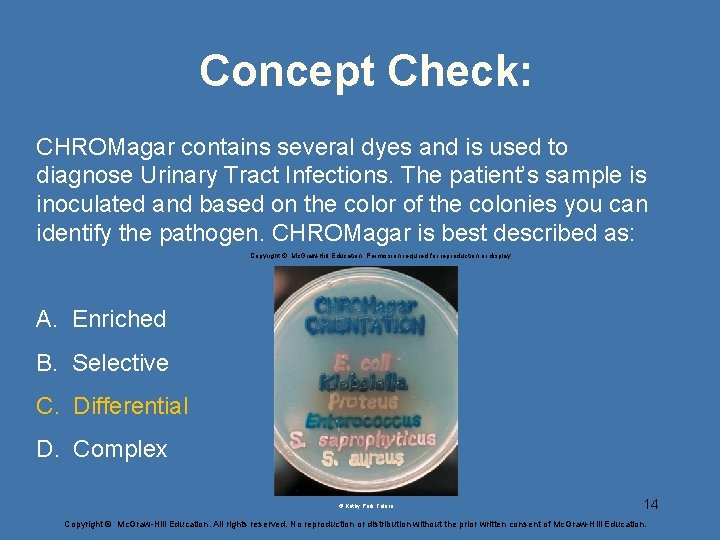 Concept Check: CHROMagar contains several dyes and is used to diagnose Urinary Tract Infections.