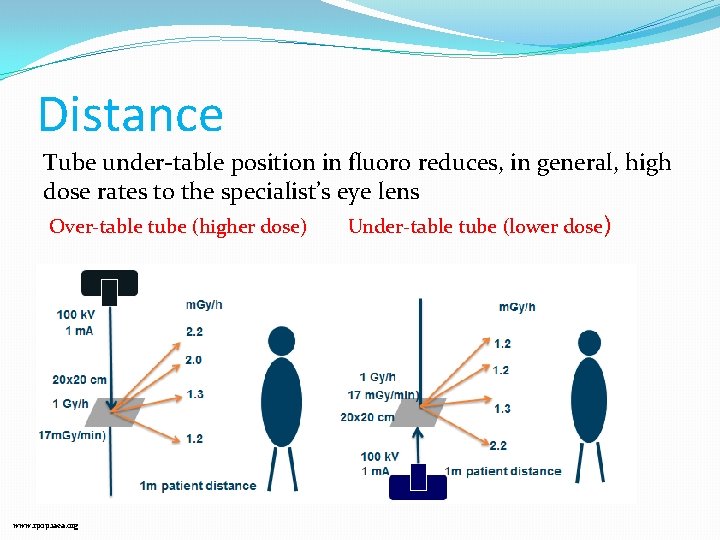 Distance Tube under-table position in fluoro reduces, in general, high dose rates to the