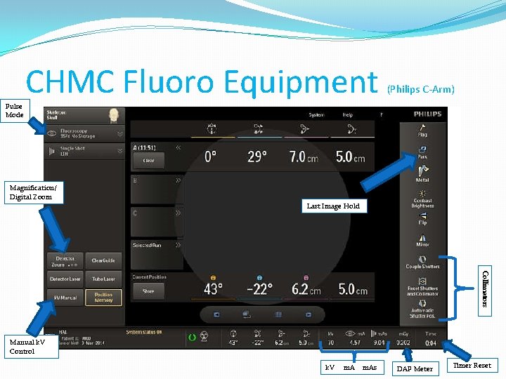 Pulse Mode CHMC Fluoro Equipment (Philips C-Arm) Magnification/ Digital Zoom Last Image Hold Collimators