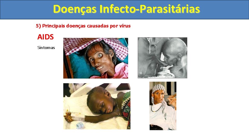 Doenças Infecto-Parasitárias 5) Principais doenças causadas por vírus AIDS Sintomas 