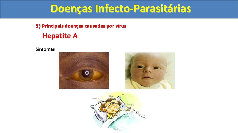 Doenças Infecto-Parasitárias 5) Principais doenças causadas por vírus Hepatite A Sintomas 