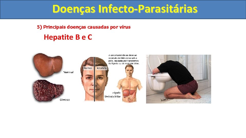 Doenças Infecto-Parasitárias 5) Principais doenças causadas por vírus Hepatite B e C 