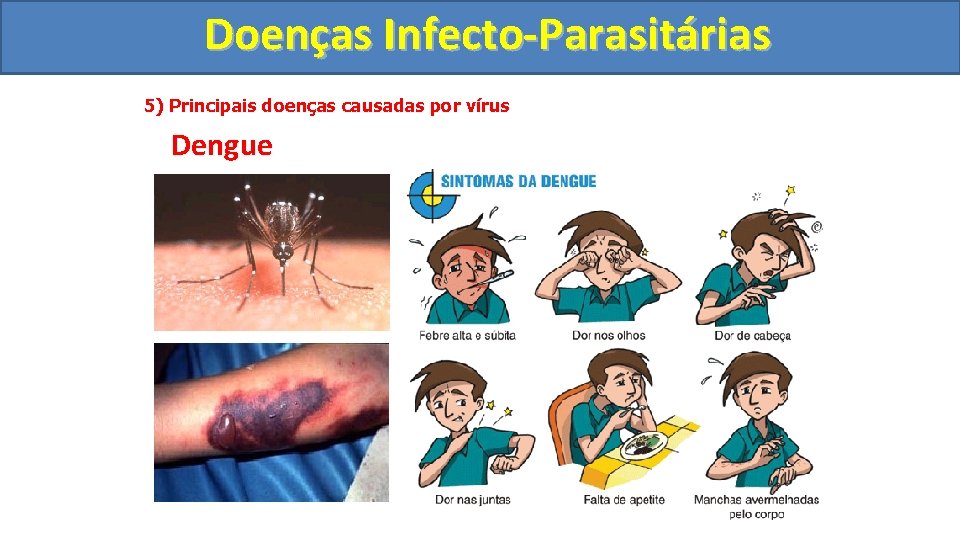 Doenças Infecto-Parasitárias 5) Principais doenças causadas por vírus Dengue 
