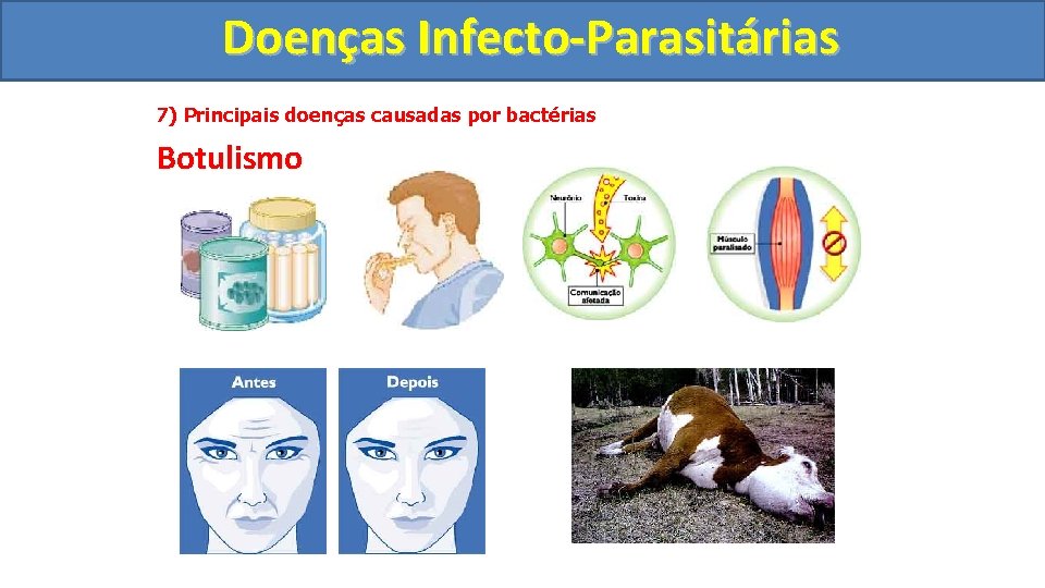 Doenças Infecto-Parasitárias 7) Principais doenças causadas por bactérias Botulismo 