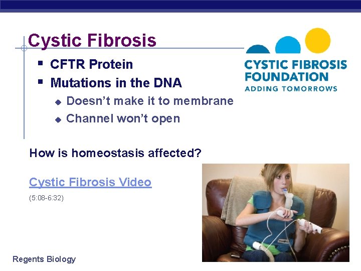Cystic Fibrosis § CFTR Protein § Mutations in the DNA u u Doesn’t make
