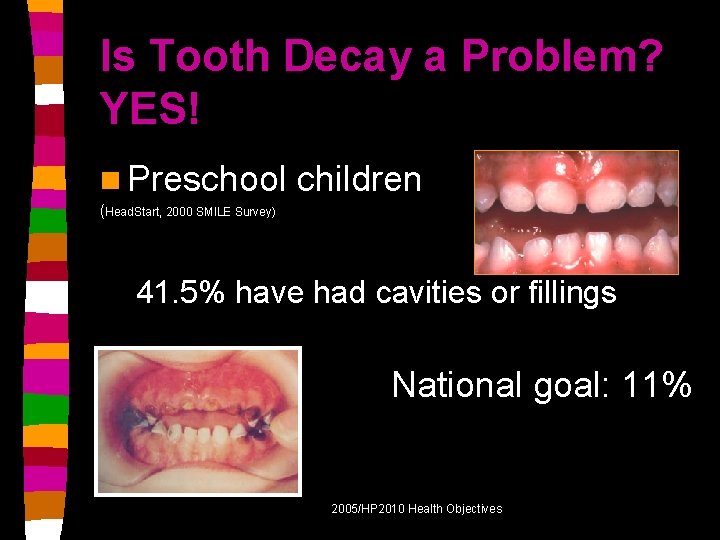 Is Tooth Decay a Problem? YES! n Preschool children (Head. Start, 2000 SMILE Survey)
