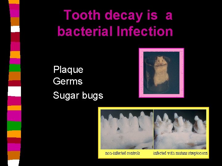 Tooth decay is a bacterial Infection Plaque Germs Sugar bugs 
