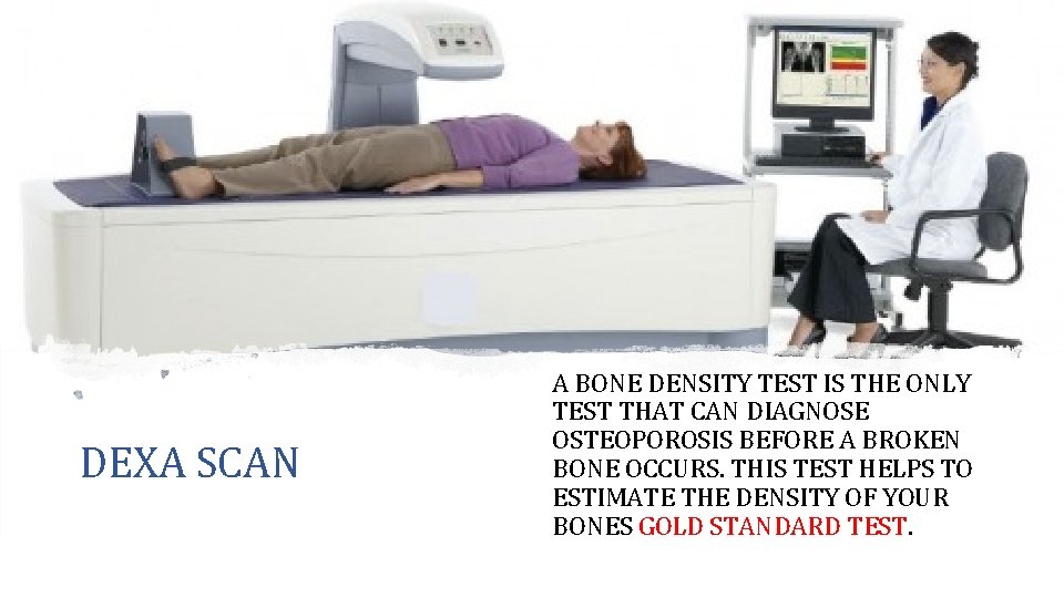 DEXA SCAN A BONE DENSITY TEST IS THE ONLY TEST THAT CAN DIAGNOSE OSTEOPOROSIS