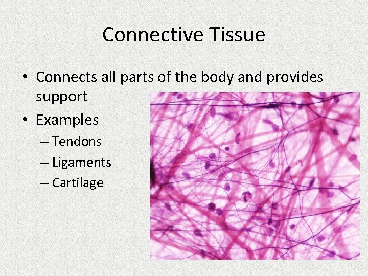 Connective Tissue • Connects all parts of the body and provides support • Examples