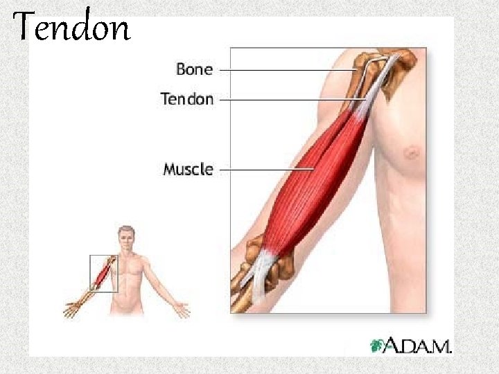 Tendon 