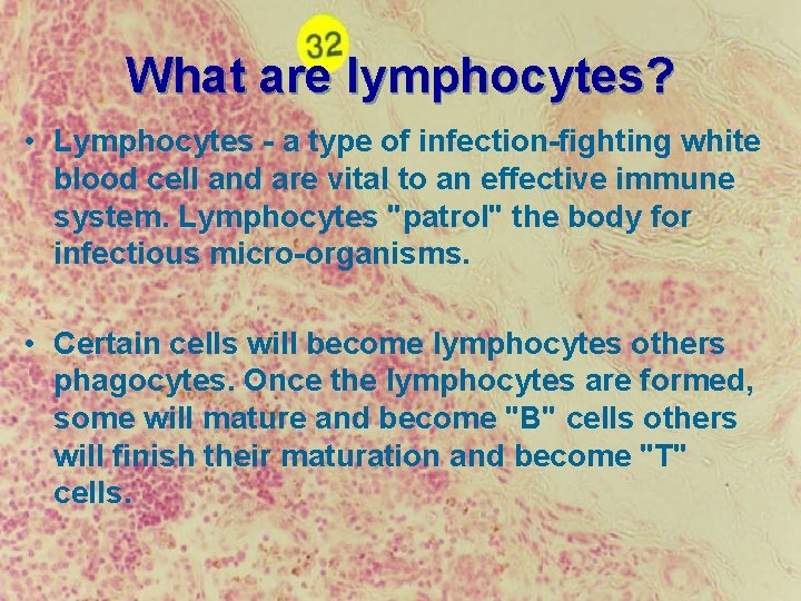 What are lymphocytes? • Lymphocytes - a type of infection-fighting white blood cell and