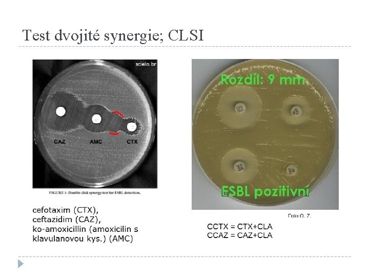 Test dvojité synergie; CLSI 