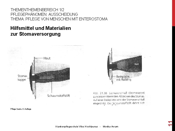 THEMENBEREICH 1/2 PFLEGEPHÄNOMEN: AUSSCHEIDUNG THEMA: PFLEGE VON MENSCHEN MIT ENTEROSTOMA Hilfsmittel und Materialien zur