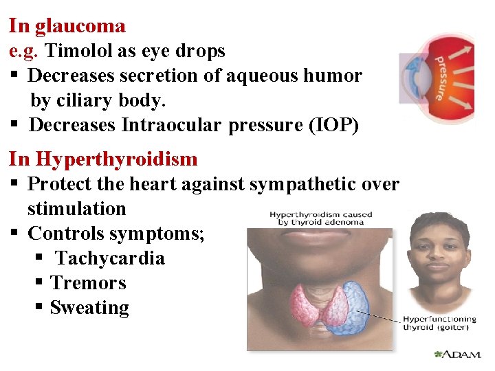 In glaucoma e. g. Timolol as eye drops § Decreases secretion of aqueous humor