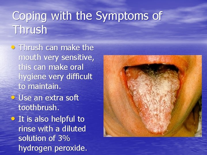 Coping with the Symptoms of Thrush • Thrush can make the • • mouth
