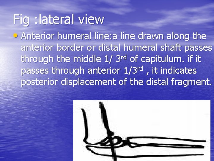 Fig : lateral view • Anterior humeral line: a line drawn along the anterior