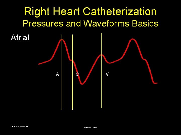 Right Heart Catheterization Pressures and Waveforms Basics Atrial A Andre Lapeyre, MD C V