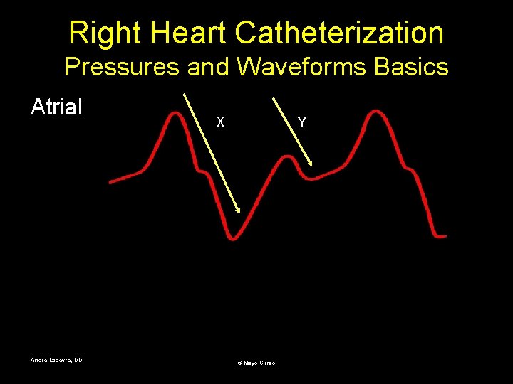 Right Heart Catheterization Pressures and Waveforms Basics Atrial Andre Lapeyre, MD X Y ©