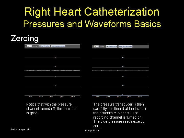 Right Heart Catheterization Pressures and Waveforms Basics Zeroing Notice that with the pressure channel