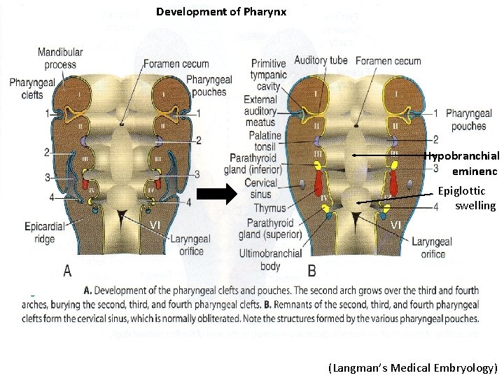 Development of Pharynx Hypobranchial eminenc Epiglottic swelling VI VI (Langman’s Medical Embryology) 