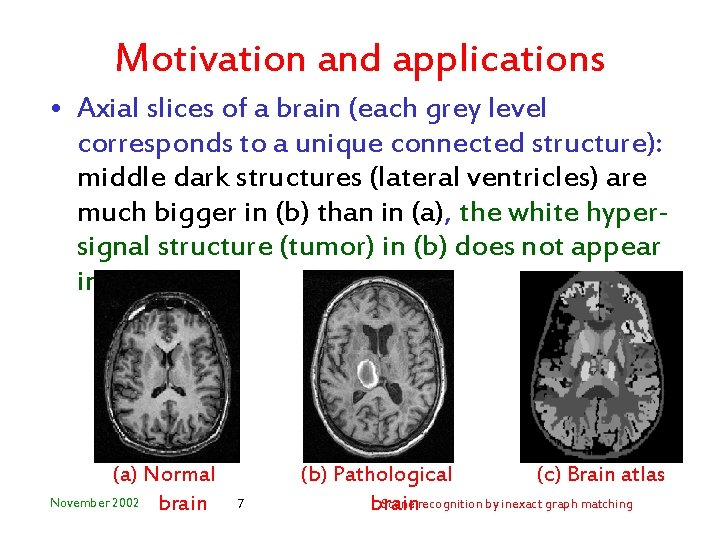 Motivation and applications • Axial slices of a brain (each grey level corresponds to