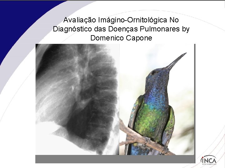 Avaliação Imágino-Ornitológica No Diagnóstico das Doenças Pulmonares by Domenico Capone 