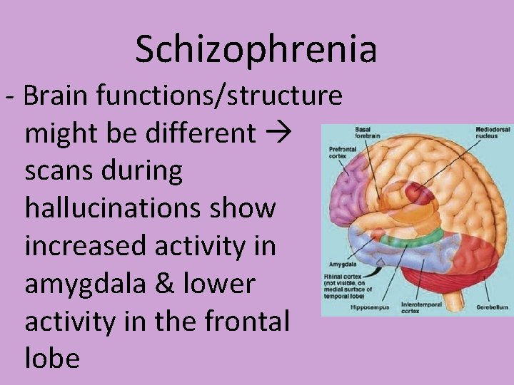 Schizophrenia - Brain functions/structure might be different scans during hallucinations show increased activity in