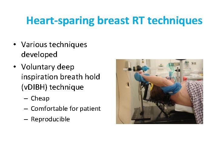 Heart-sparing breast RT techniques • Various techniques developed • Voluntary deep inspiration breath hold