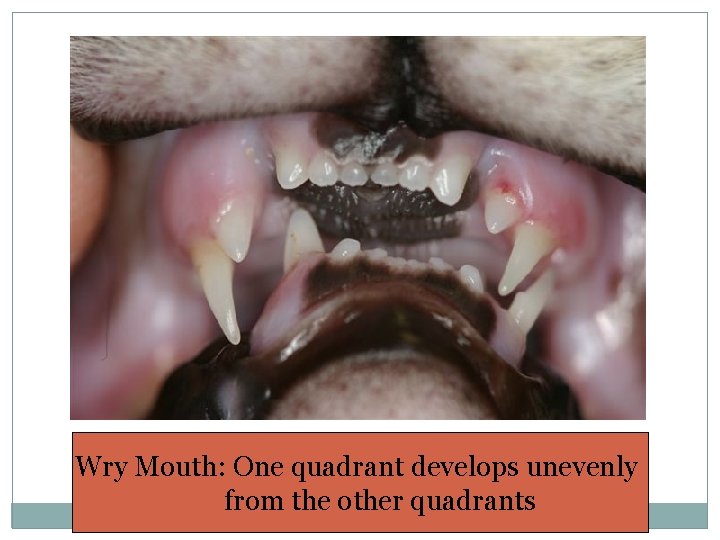 Wry Mouth: One quadrant develops unevenly from the other quadrants 