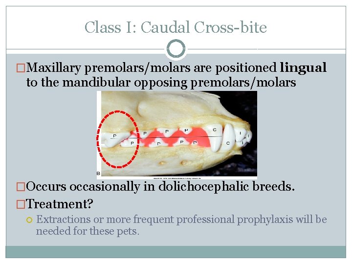 Class I: Caudal Cross-bite �Maxillary premolars/molars are positioned lingual to the mandibular opposing premolars/molars