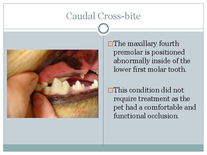 Caudal Cross-bite �The maxillary fourth premolar is positioned abnormally inside of the lower first