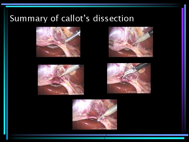 Summary of callot’s dissection 