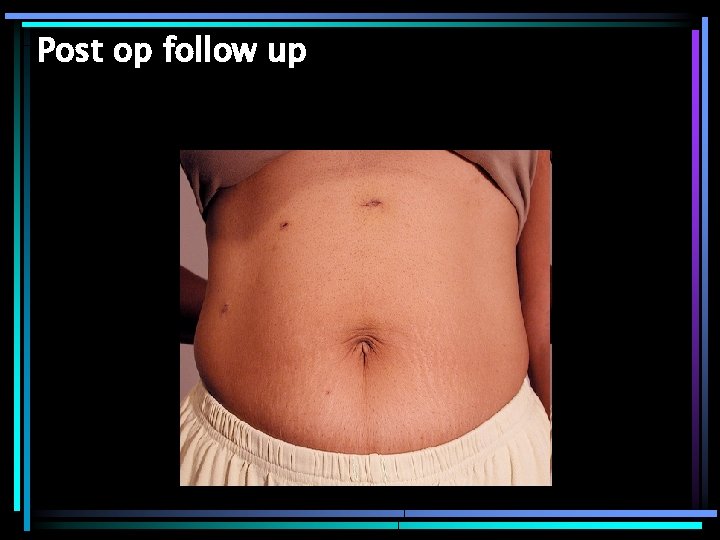 Post op follow up 