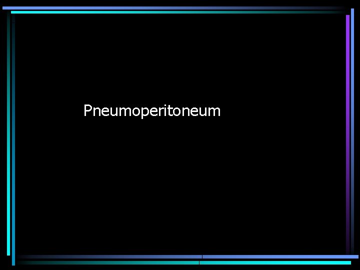 Pneumoperitoneum 