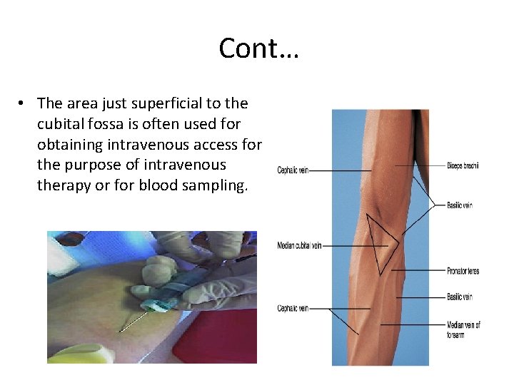 Cont… • The area just superficial to the cubital fossa is often used for