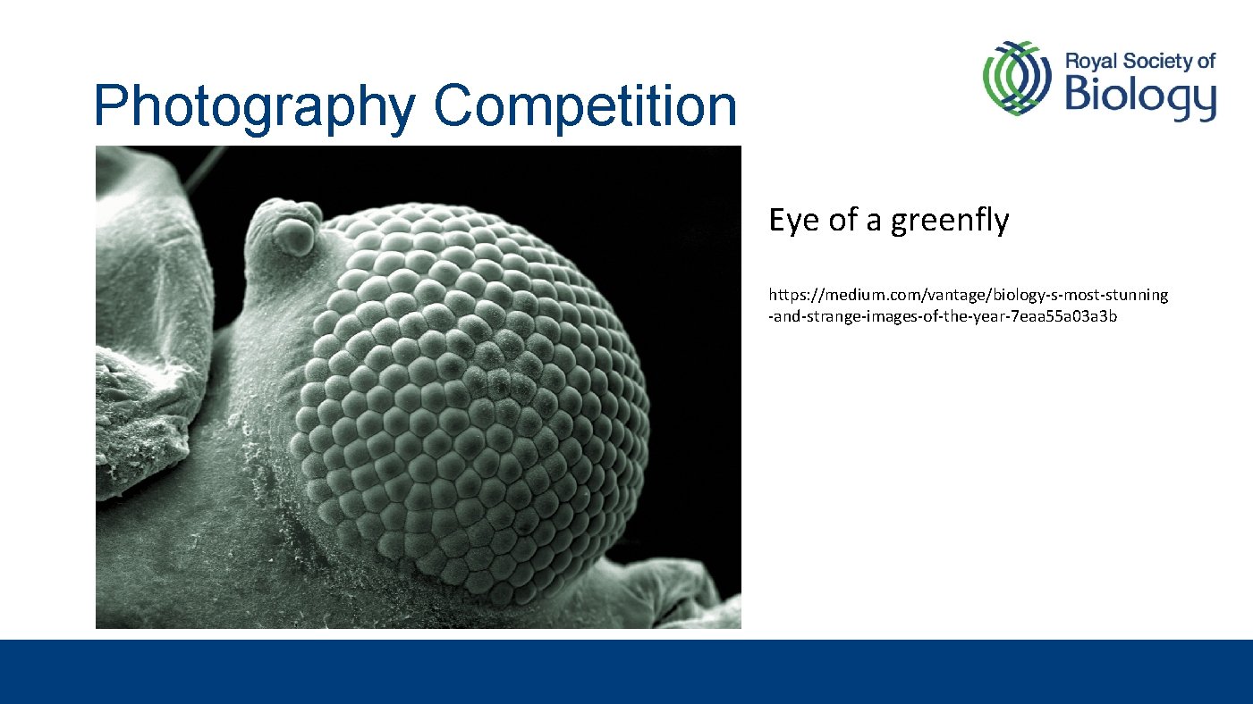 Photography Competition Eye of a greenfly https: //medium. com/vantage/biology-s-most-stunning -and-strange-images-of-the-year-7 eaa 55 a 03