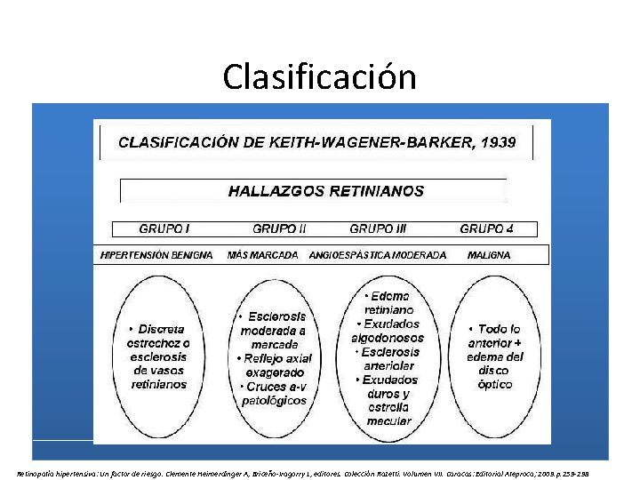 Clasificación Retinopatía hipertensiva: Un factor de riesgo. Clemente Heimerdinger A, Briceño-Iragorry L, editores. Colección