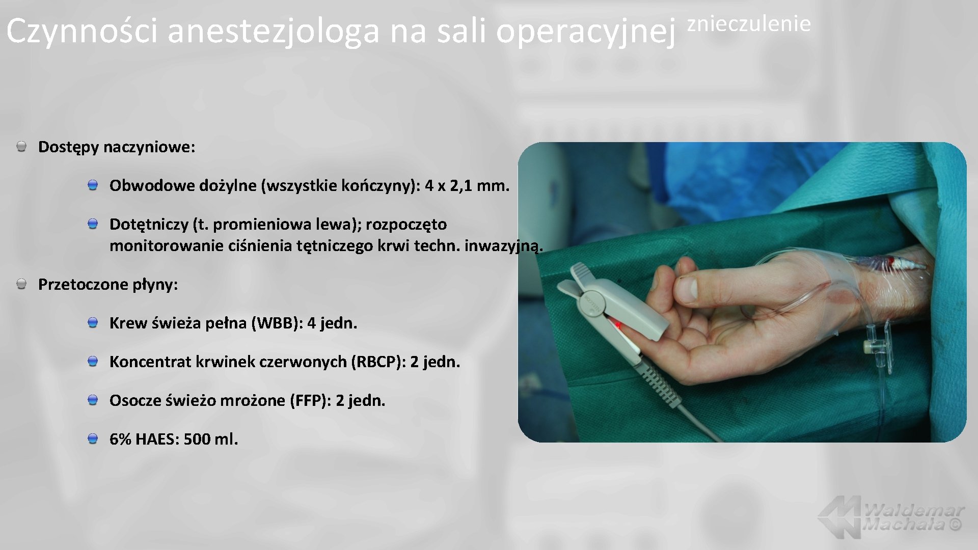 Czynności anestezjologa na sali operacyjnej Dostępy naczyniowe: Obwodowe dożylne (wszystkie kończyny): 4 x 2,