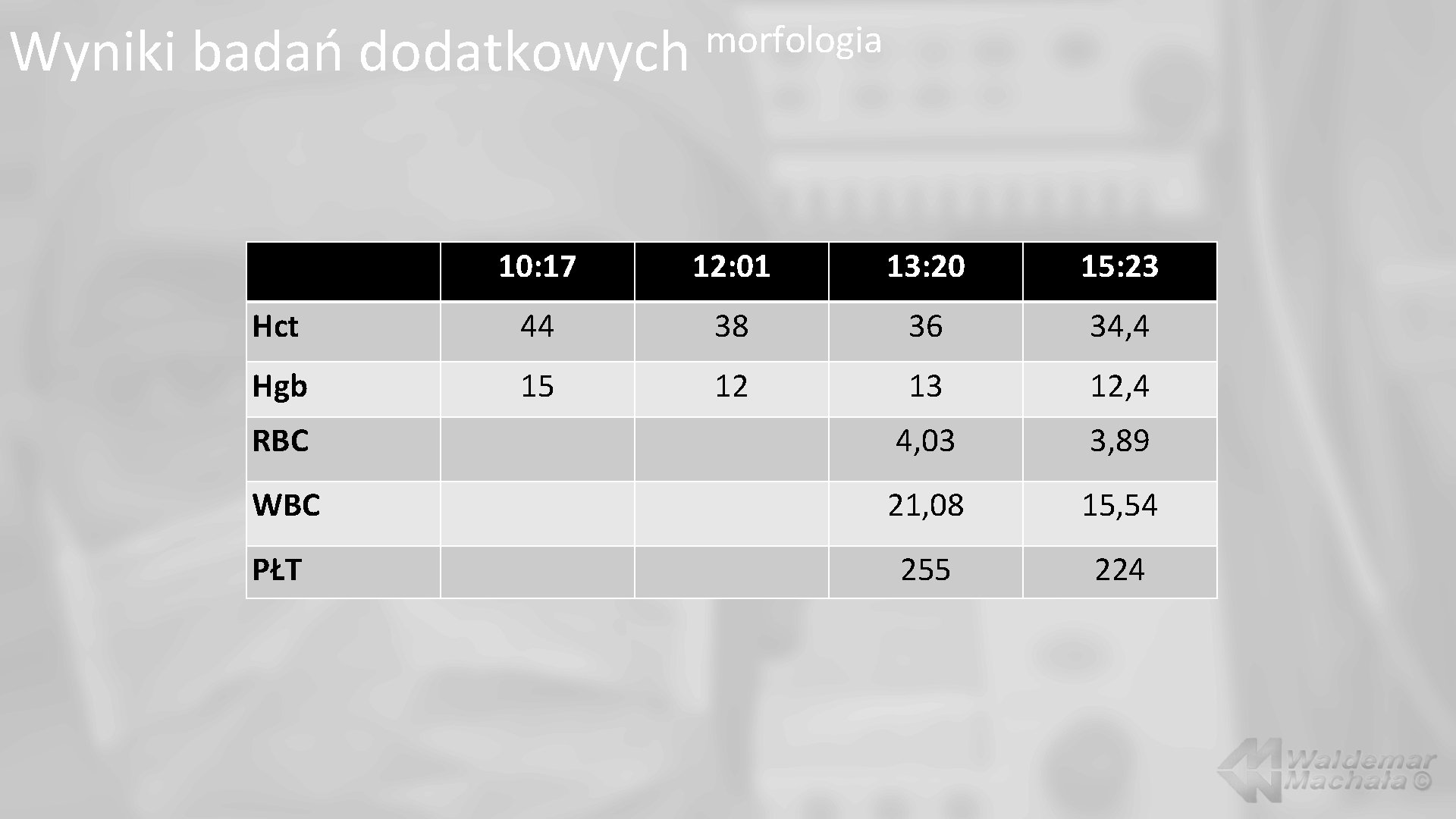 Wyniki badań dodatkowych morfologia 10: 17 12: 01 13: 20 15: 23 Hct 44