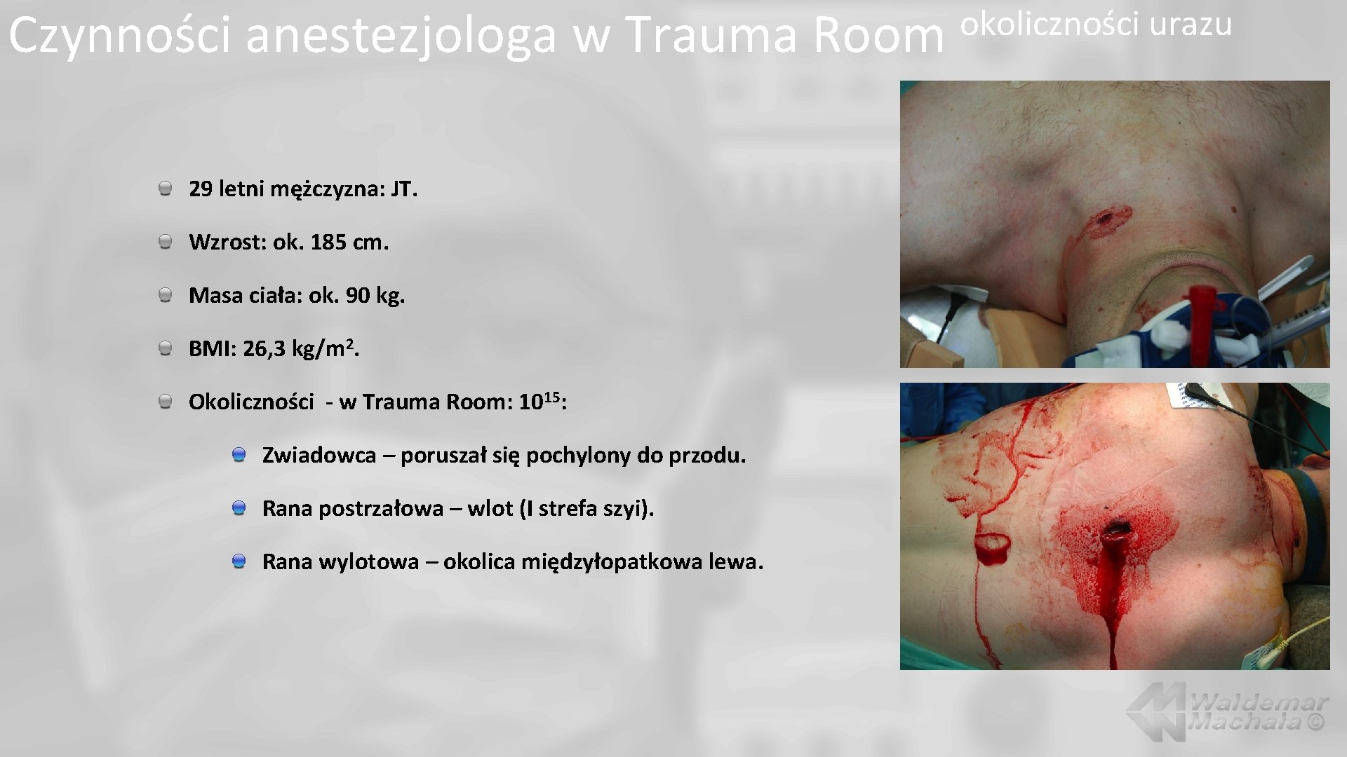 Czynności anestezjologa w Trauma Room 29 letni mężczyzna: JT. Wzrost: ok. 185 cm. Masa