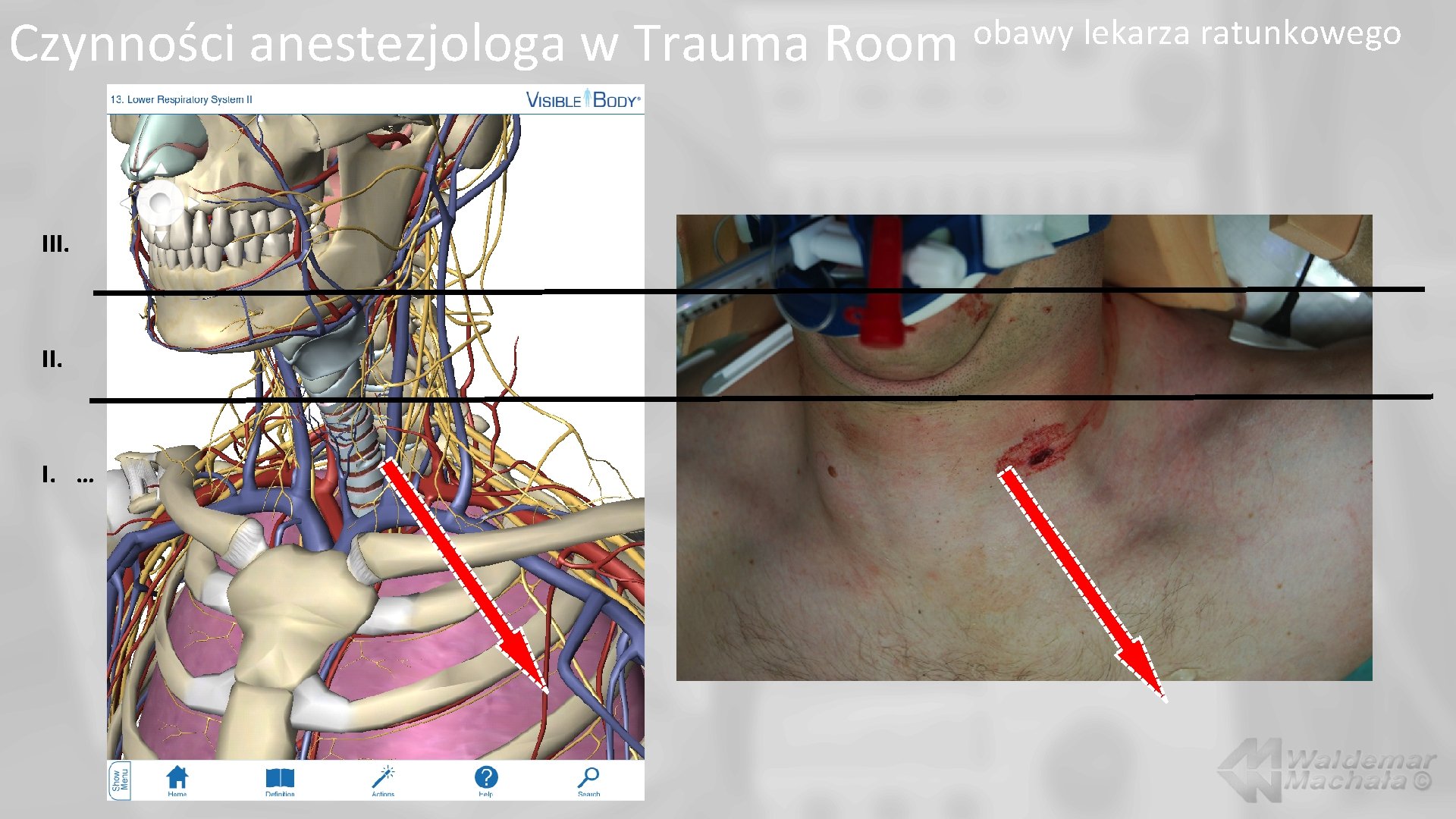 Czynności anestezjologa w Trauma Room III. I. … obawy lekarza ratunkowego 