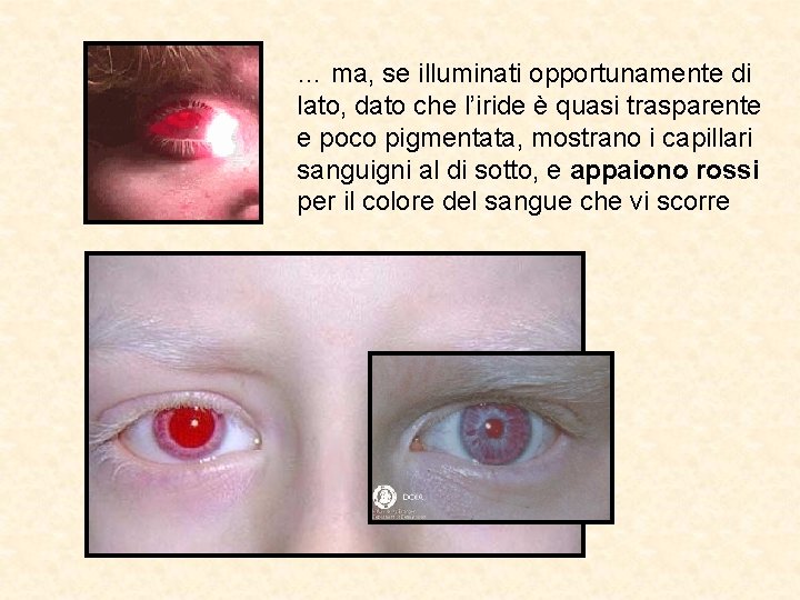 … ma, se illuminati opportunamente di lato, dato che l’iride è quasi trasparente e