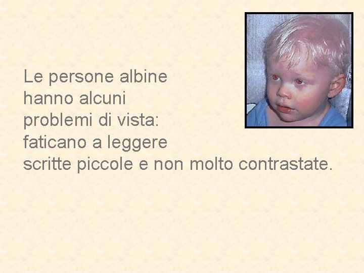 Le persone albine hanno alcuni problemi di vista: faticano a leggere scritte piccole e