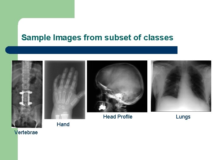 Sample Images from subset of classes Head Profile Hand Vertebrae Lungs 