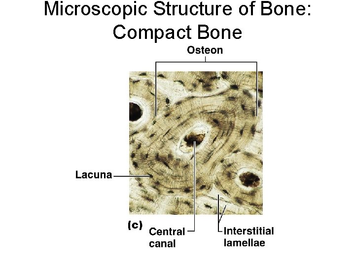 Microscopic Structure of Bone: Compact Bone 